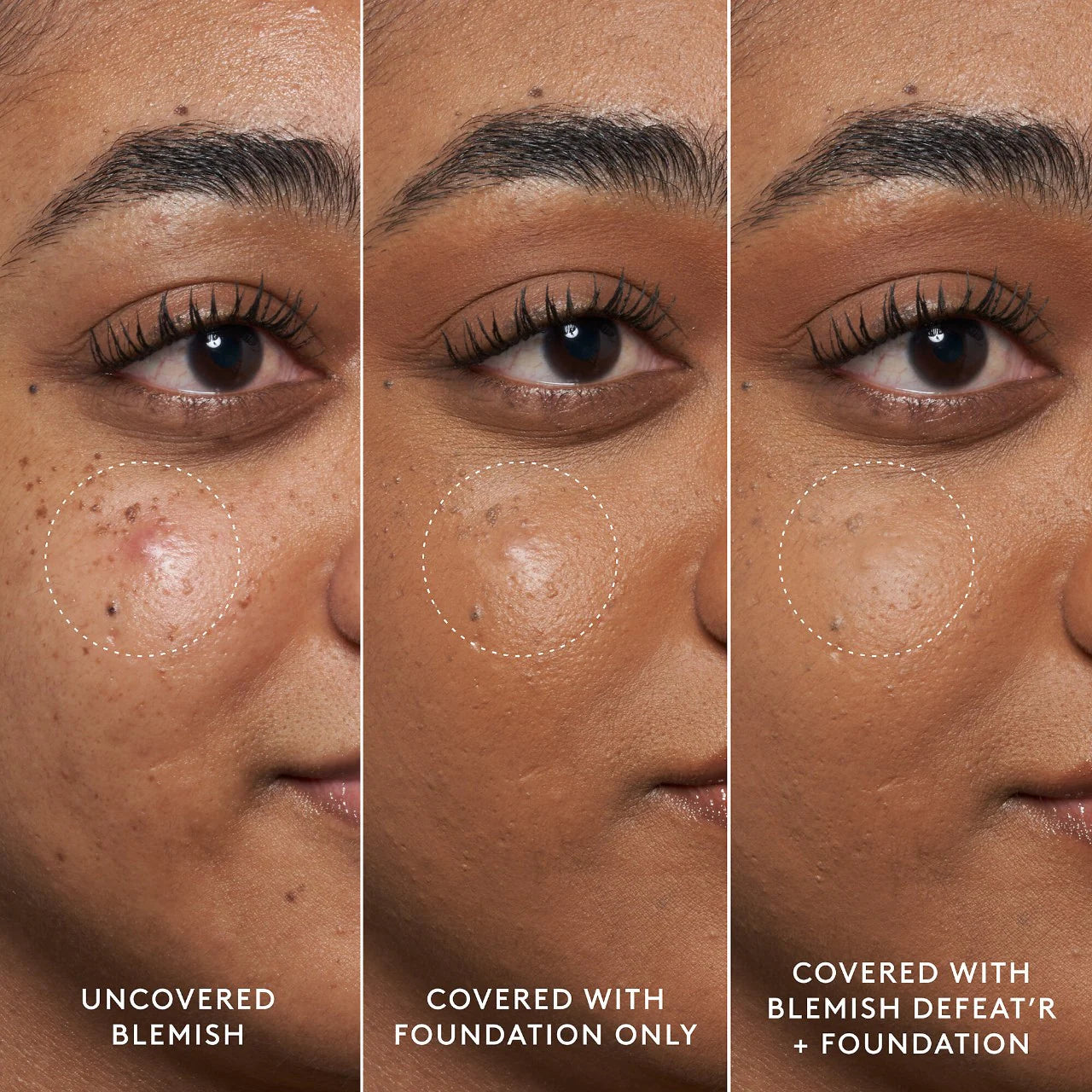 Fenty beauty tratamiento granitos
