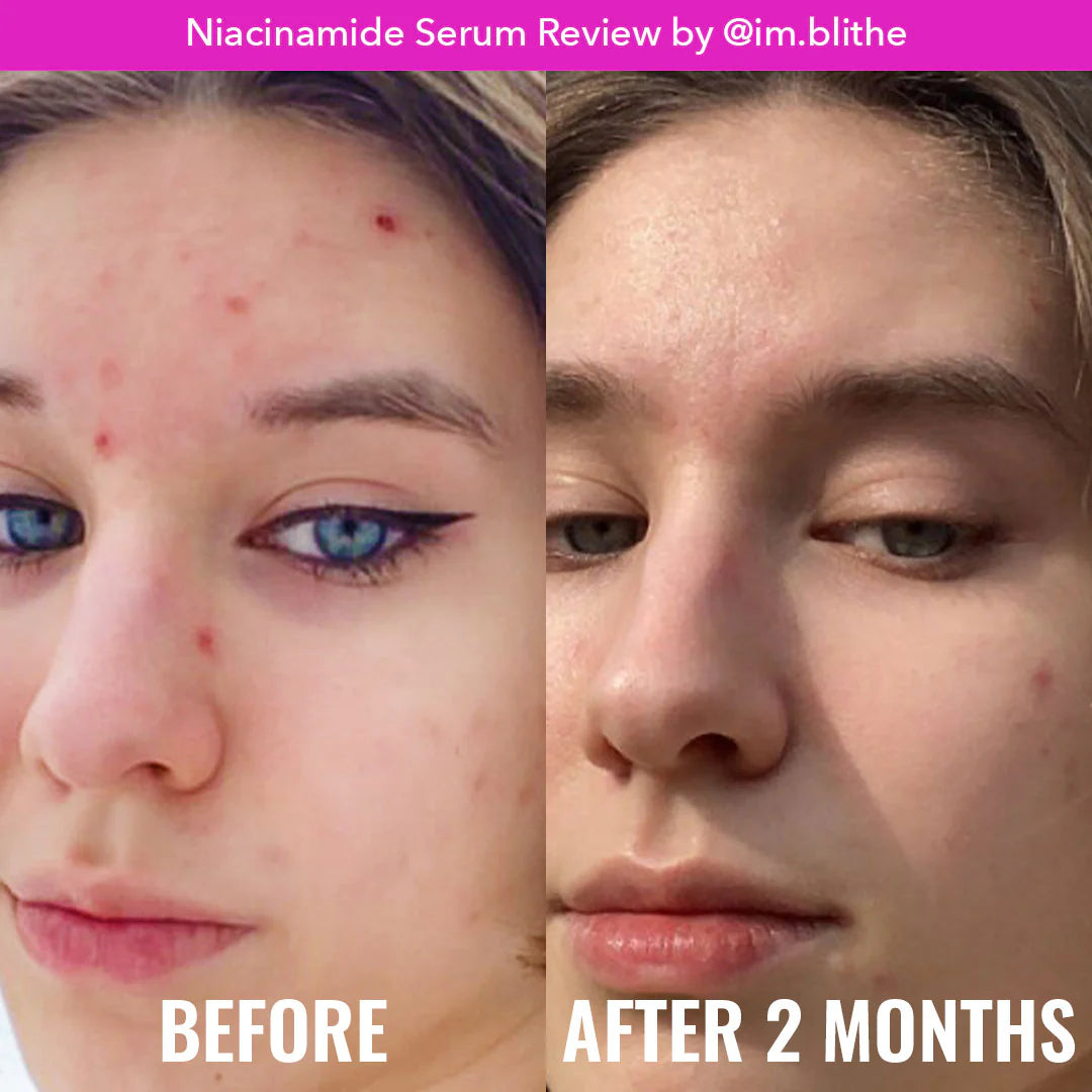 Good molecules niacinamida