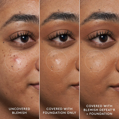Fenty beauty tratamiento granitos